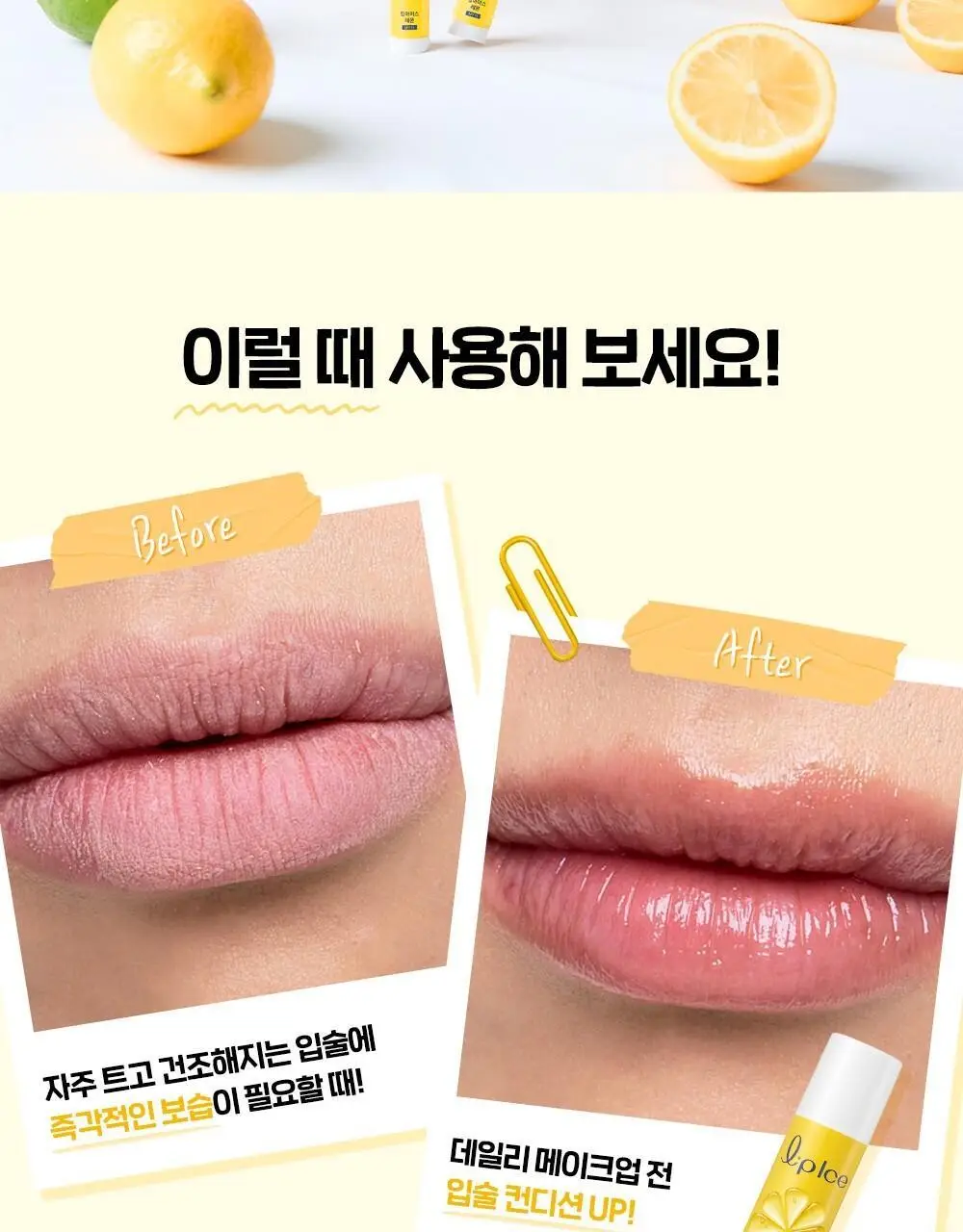 [촉촉보습/진짜과즙] 멘소래담 립아이스 립밤 레몬 3.5g 상세페이지 7
